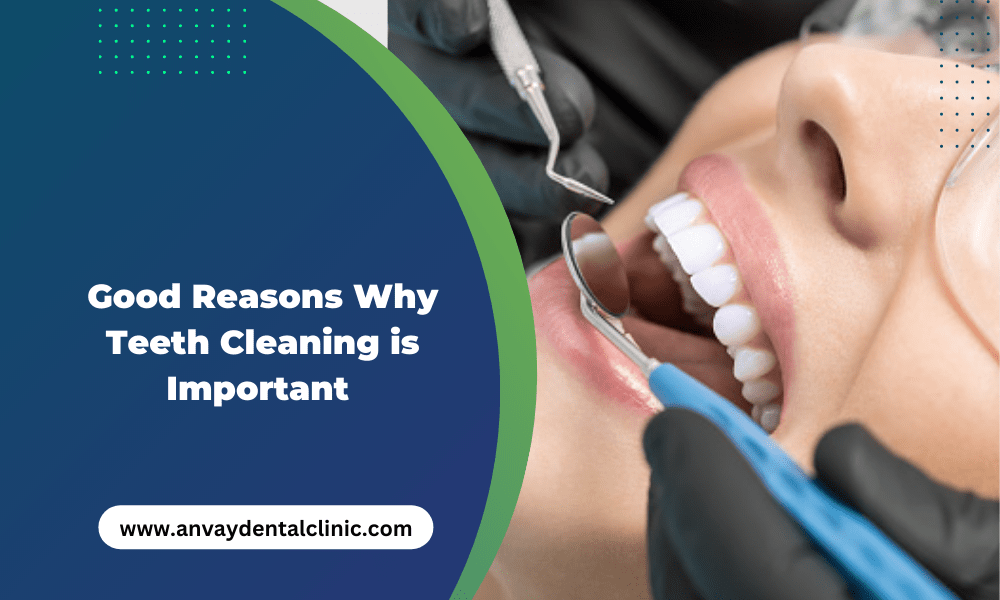 Good Reasons Why Teeth Cleaning is Important