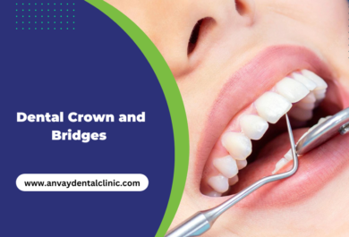 dental crown and bridge at anvay dental clinic memnagar ahmedabad