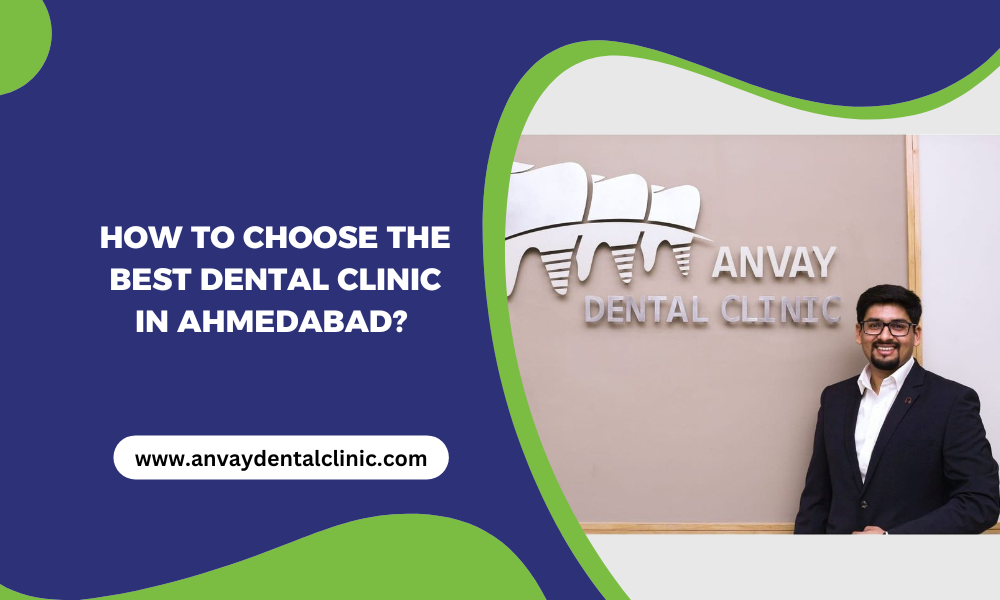 how to choose the best dental clinic in ahmedabad