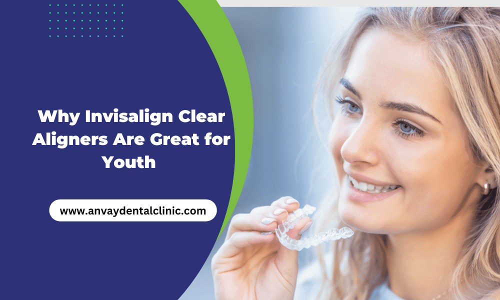 why invisalign clear aligners are great for yourth