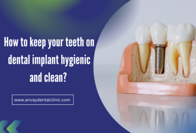 Dental Implants Hygiene and clean at anvay dental clinic memnagar ahmedabad