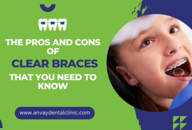 Pros and Cons of Clear Braces at anvay dental clinic memnagar ahmedabad