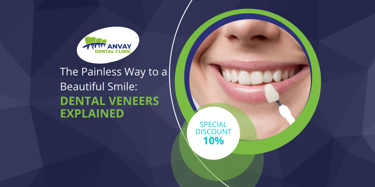 The Painless Way to a Beautiful Smile: Dental Veneers Explained