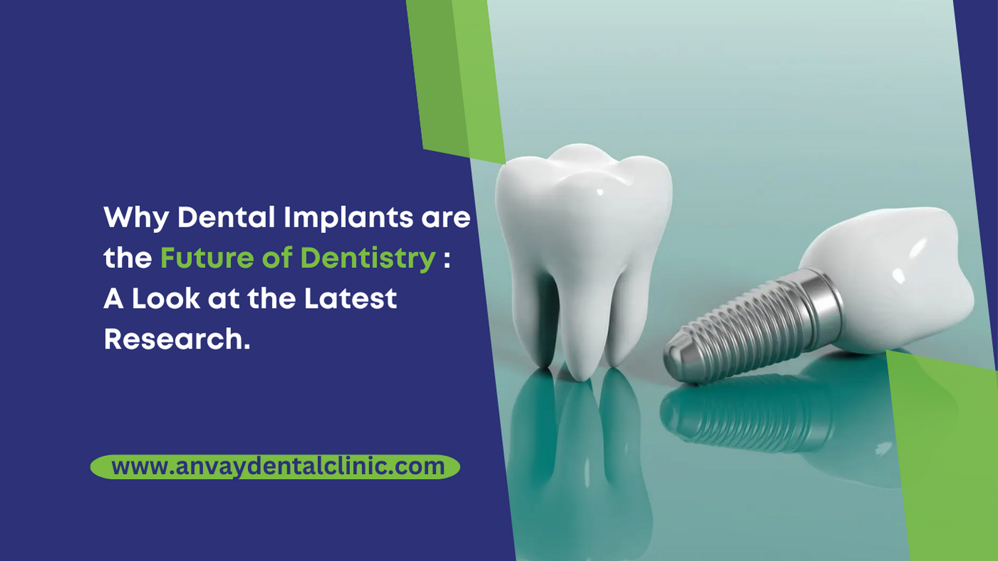 Why Dental Implants are the Future of Dentistry A Look at the Latest Research